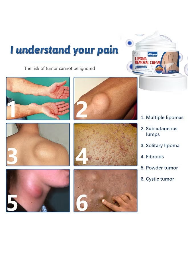 SOUTH MOON 2pc Lipoma Removal Cream, Underarm And Neck Lymphatic Care Cream, Lymphatic Drainage Cream, Anti-Cellulite Remover Cream, For Lipolysis Fat Lump Removal And Nodular Discomfort For Body And Face 2x50G - Image 4